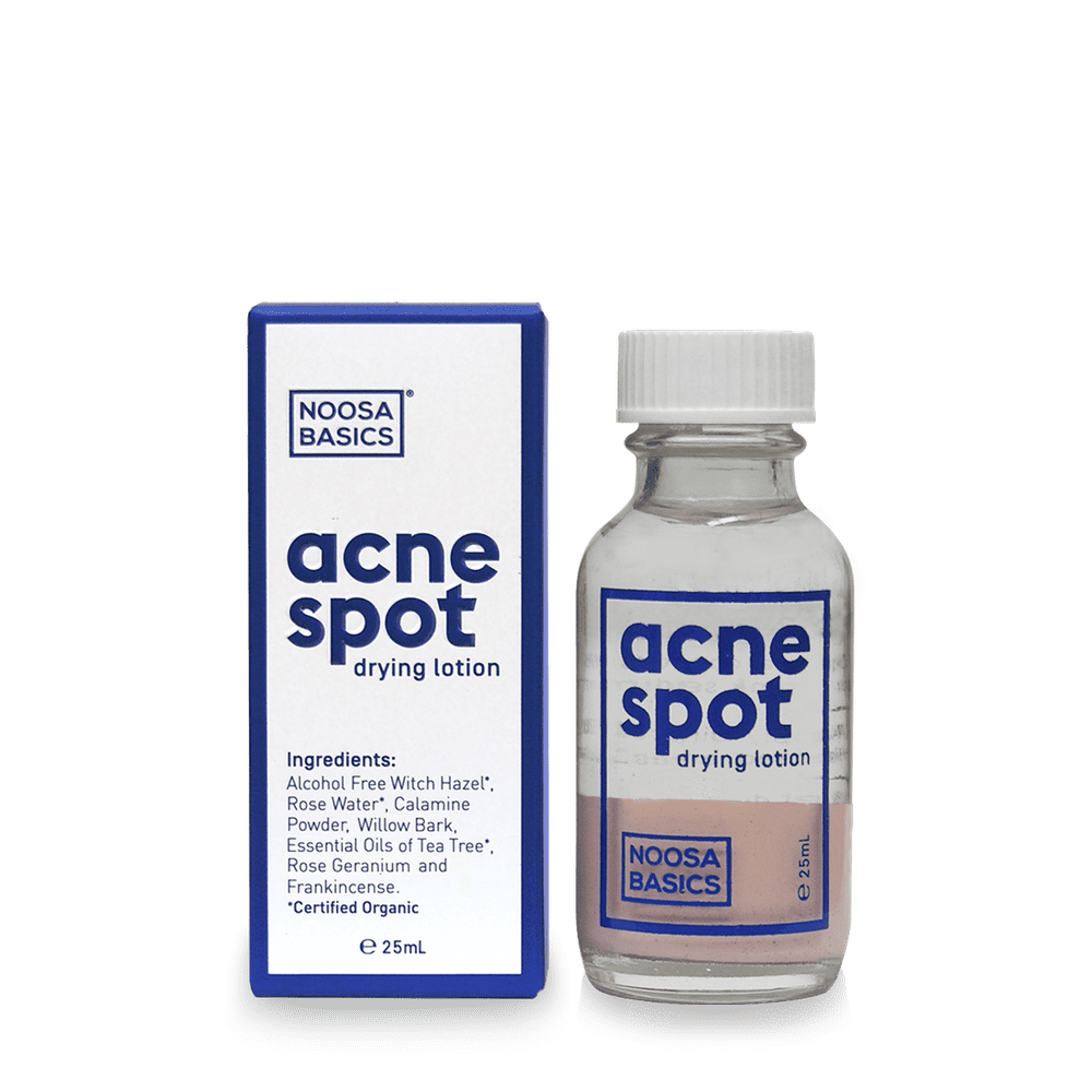 Noosa Basics Acne Lotion 25ml
